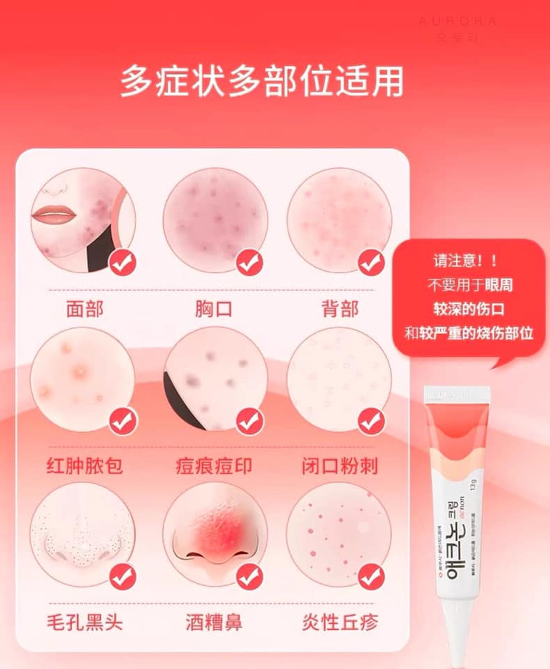 Korean Dongah Acnon Cream Dongah Pharmaceutical Anti-inflammatory, Bactericidal and Acne Cream