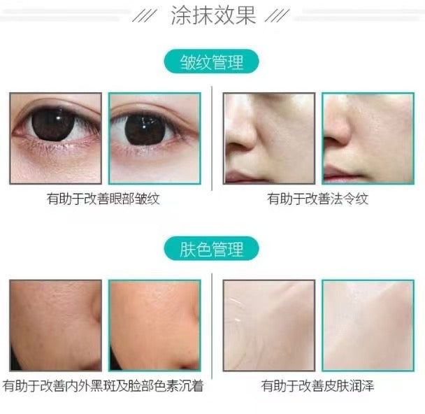 Rejuran Korea Rejuran Anti-Aging Water Light Essence 10ml