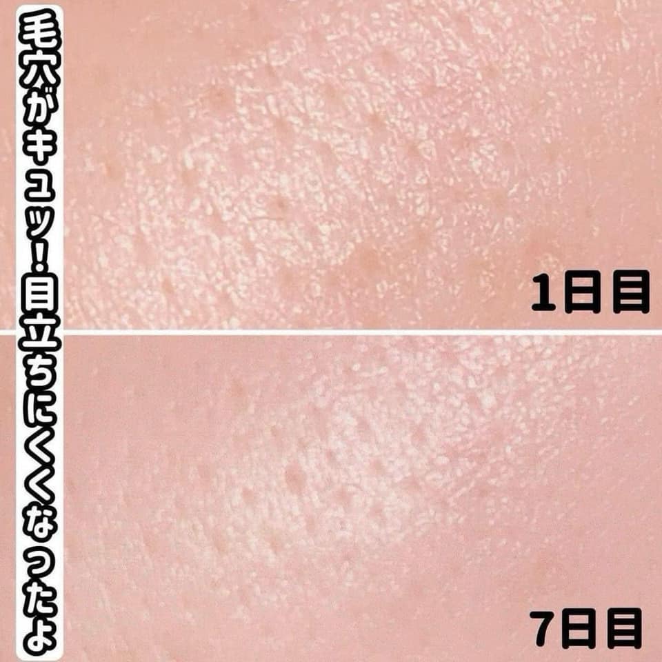 韓國 VT Reedle Shot 100 微針精華 2 STEP 面膜 (任選4片)