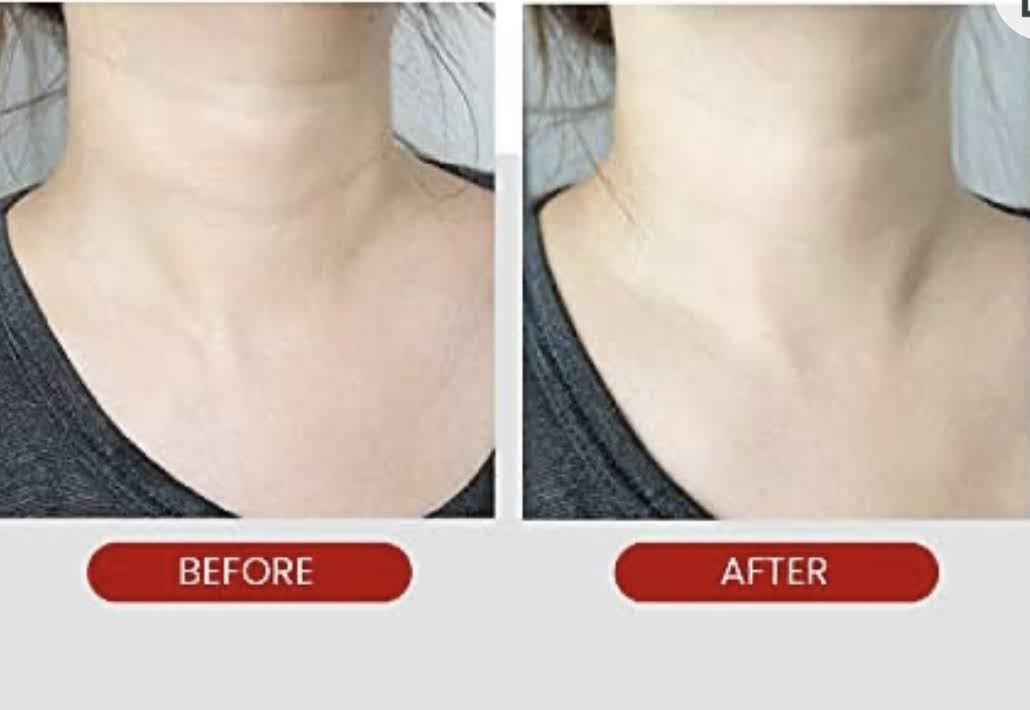 South Korea Medipeel Cindella all-purpose perfect multi-effect ampoule concentrated essence 100ml