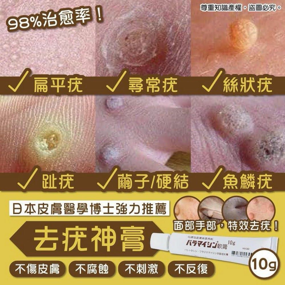 日本皮膚醫學博士強力推薦 去疣神膏10g