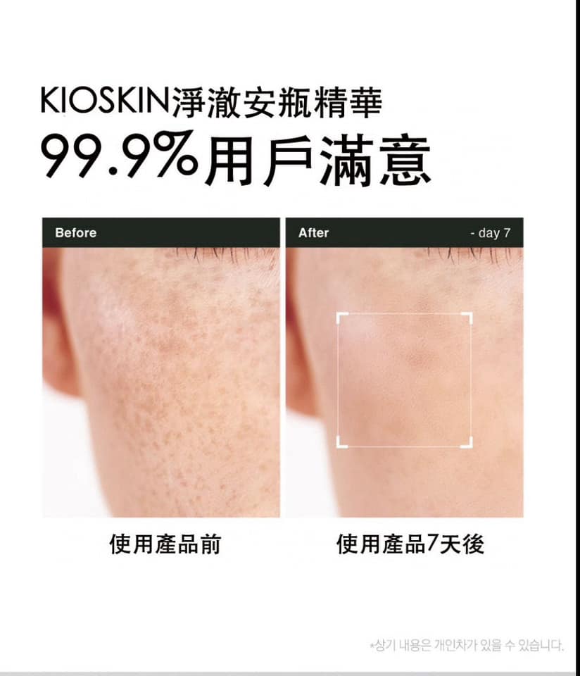 韓國 KIOSKIN L-Cysteine Melacare 淡斑安瓶精華液套盒 10ml X4