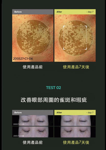 韓國 KIOSKIN L-Cysteine Melacare 淡斑安瓶精華液套盒 10ml X4