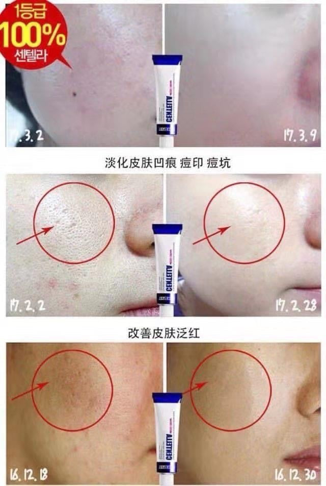 MEDIPEEL 積雪草高效保濕修復霜