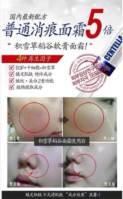 MEDIPEEL 積雪草高效保濕修復霜