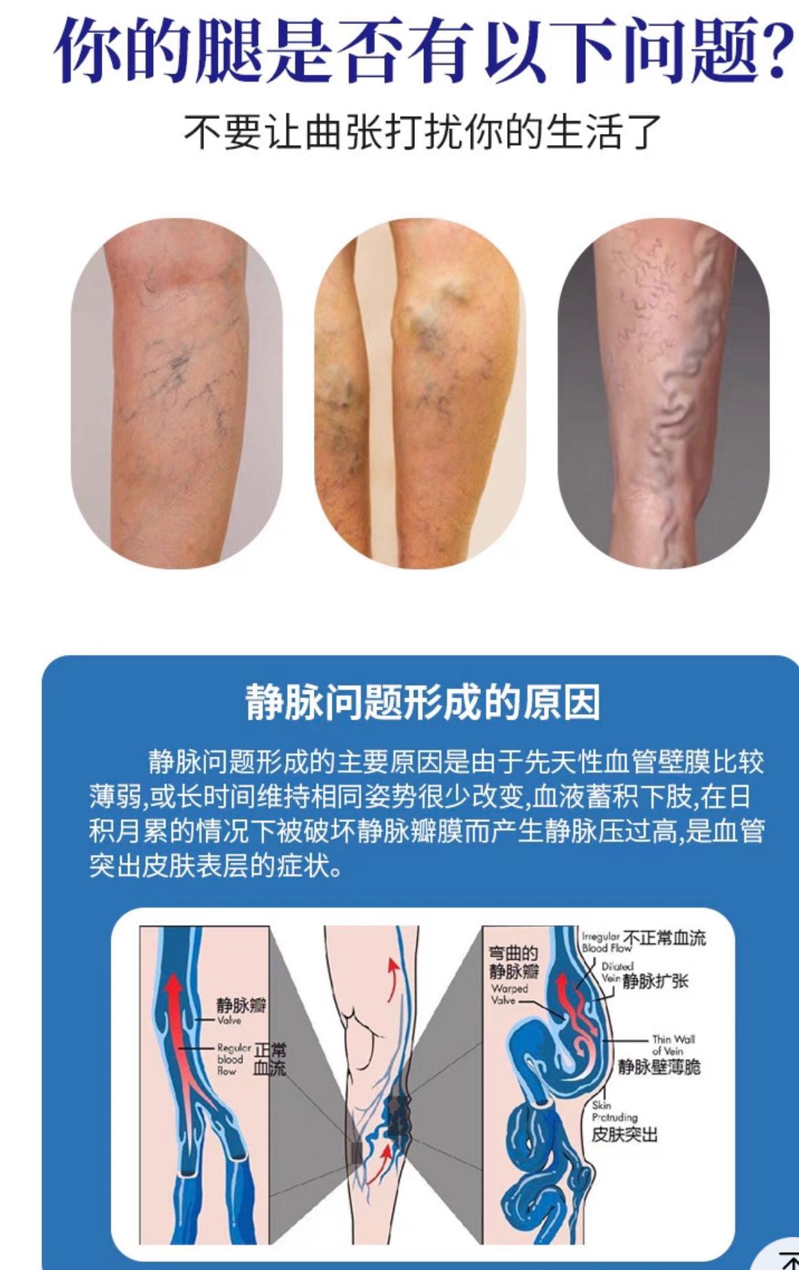 Dongtian Vein Kangshu Health Care Solution Qingjinle Care Herbal Spray (2 bottles)