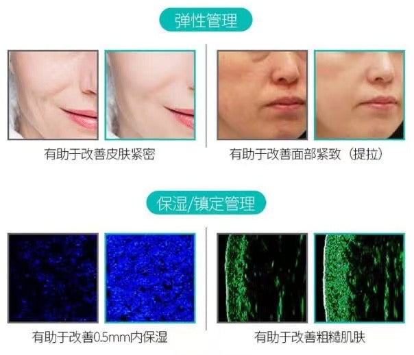 Rejuran Korea Rejuran Anti-Aging Water Light Essence 10ml